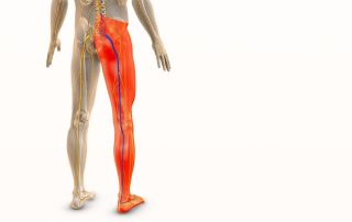 sciatica treatment Mason OH chiropractor